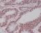MutS Homolog 6 antibody, M00553, Boster Biological Technology, Immunohistochemistry frozen image 