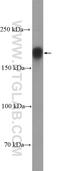 Centrosomal Protein 170 antibody, 27325-1-AP, Proteintech Group, Western Blot image 