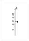 Von Willebrand Factor antibody, M00270-2, Boster Biological Technology, Western Blot image 