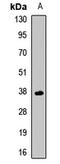 Chondromodulin antibody, orb412474, Biorbyt, Western Blot image 
