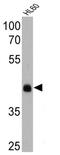 Rhodopsin antibody, GTX25417, GeneTex, Western Blot image 