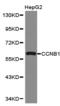 Cyclin B1 antibody, TA327246, Origene, Western Blot image 