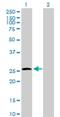 Uroporphyrinogen III Synthase antibody, H00007390-B01P, Novus Biologicals, Western Blot image 