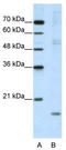 Nucleolar Pre-RRNA Processing Protein NIP7 antibody, TA343842, Origene, Western Blot image 