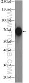 Transcobalamin 1 antibody, 16078-1-AP, Proteintech Group, Western Blot image 