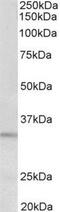 Peptidase Inhibitor 15 antibody, NBP2-11581, Novus Biologicals, Western Blot image 