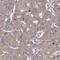 WD Repeat Domain 59 antibody, HPA048218, Atlas Antibodies, Immunohistochemistry paraffin image 