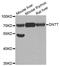 DNA Nucleotidylexotransferase antibody, LS-C334595, Lifespan Biosciences, Western Blot image 