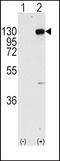 Fibroblast Growth Factor Receptor 1 antibody, PA5-14648, Invitrogen Antibodies, Western Blot image 