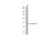 Beta-Transducin Repeat Containing E3 Ubiquitin Protein Ligase antibody, NBP1-33301, Novus Biologicals, Western Blot image 