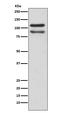 Catenin Delta 1 antibody, M02333, Boster Biological Technology, Western Blot image 