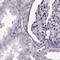 Trichohyalin Like 1 antibody, NBP1-80806, Novus Biologicals, Immunohistochemistry paraffin image 