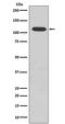 RB Transcriptional Corepressor 1 antibody, P00039-1, Boster Biological Technology, Western Blot image 