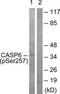 Caspase 6 antibody, TA311849, Origene, Western Blot image 