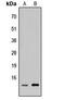 Neuronal protein 3.1 antibody, abx121539, Abbexa, Western Blot image 