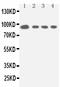 Signal Transducer And Activator Of Transcription 5A antibody, PA1840, Boster Biological Technology, Western Blot image 