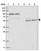 REC8 Meiotic Recombination Protein antibody, NBP1-87144, Novus Biologicals, Western Blot image 