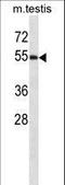 WW Domain Containing Oxidoreductase antibody, LS-C160649, Lifespan Biosciences, Western Blot image 