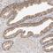 OFD1 Centriole And Centriolar Satellite Protein antibody, HPA031104, Atlas Antibodies, Immunohistochemistry paraffin image 