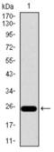 Integrin Subunit Beta 4 antibody, abx015900, Abbexa, Western Blot image 