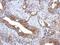 Glucosaminyl (N-Acetyl) Transferase 3, Mucin Type antibody, GTX122901, GeneTex, Immunohistochemistry paraffin image 