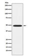 ATPase Na+/K+ Transporting Subunit Beta 1 antibody, M03469, Boster Biological Technology, Western Blot image 