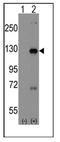 Dishevelled Associated Activator Of Morphogenesis 1 antibody, AP12339PU-N, Origene, Western Blot image 