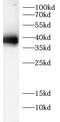 Protein Phosphatase 1 Regulatory Subunit 15A antibody, FNab10772, FineTest, Western Blot image 