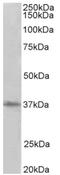 Protein Arginine Methyltransferase 2 antibody, AP33502PU-N, Origene, Western Blot image 