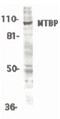 MDM2 Binding Protein antibody, PA5-19979, Invitrogen Antibodies, Western Blot image 