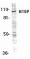 MDM2 Binding Protein antibody, PA5-19979, Invitrogen Antibodies, Western Blot image 