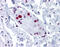U1 small nuclear ribonucleoprotein A antibody, 51-512, ProSci, Immunohistochemistry paraffin image 