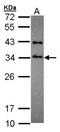 SET Nuclear Proto-Oncogene antibody, orb74191, Biorbyt, Western Blot image 
