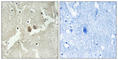 Neuronal Vesicle Trafficking Associated 2 antibody, abx014662, Abbexa, Western Blot image 