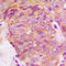 Growth Factor Receptor Bound Protein 14 antibody, LS-C352265, Lifespan Biosciences, Immunohistochemistry paraffin image 