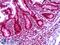 TARBP2 Subunit Of RISC Loading Complex antibody, LS-B6386, Lifespan Biosciences, Immunohistochemistry paraffin image 