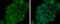 Thrombomodulin antibody, GTX108277, GeneTex, Immunocytochemistry image 