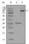 ETS Variant 1 antibody, AM06285SU-N, Origene, Western Blot image 