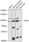 Transglutaminase 1 antibody, 14-944, ProSci, Western Blot image 