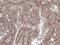 Presenilin 1 antibody, LS-C776447, Lifespan Biosciences, Immunohistochemistry paraffin image 