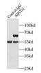 ATP Binding Cassette Subfamily G Member 1 antibody, FNab00042, FineTest, Immunoprecipitation image 