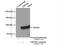 Leucine Rich Repeats And WD Repeat Domain Containing 1 antibody, 19546-1-AP, Proteintech Group, Immunoprecipitation image 