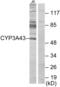 Cytochrome P450 Family 3 Subfamily A Member 43 antibody, abx013990, Abbexa, Western Blot image 