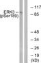 Mitogen-Activated Protein Kinase 6 antibody, PA5-38485, Invitrogen Antibodies, Western Blot image 