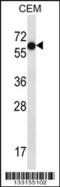 Transcription Factor AP-2 Beta antibody, 56-956, ProSci, Western Blot image 