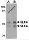 Kruppel Like Factor 4 antibody, 5603, ProSci, Western Blot image 