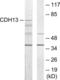 Cadherin 13 antibody, LS-C119406, Lifespan Biosciences, Western Blot image 