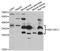 Nuclear Factor Kappa B Subunit 1 antibody, orb19572, Biorbyt, Western Blot image 