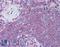 Inhibitor Of Nuclear Factor Kappa B Kinase Subunit Epsilon antibody, LS-B117, Lifespan Biosciences, Immunohistochemistry frozen image 