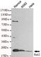 RAB2A, Member RAS Oncogene Family antibody, MBS475074, MyBioSource, Western Blot image 